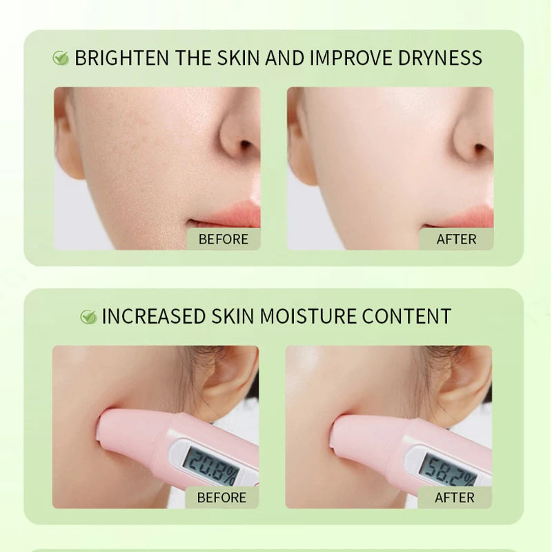 Korean 5% Panthenol Calming Serum Green Tea Essence Soothing Moisturizing For Sensitive Acne Prone Daily SkinCare Beauty Product