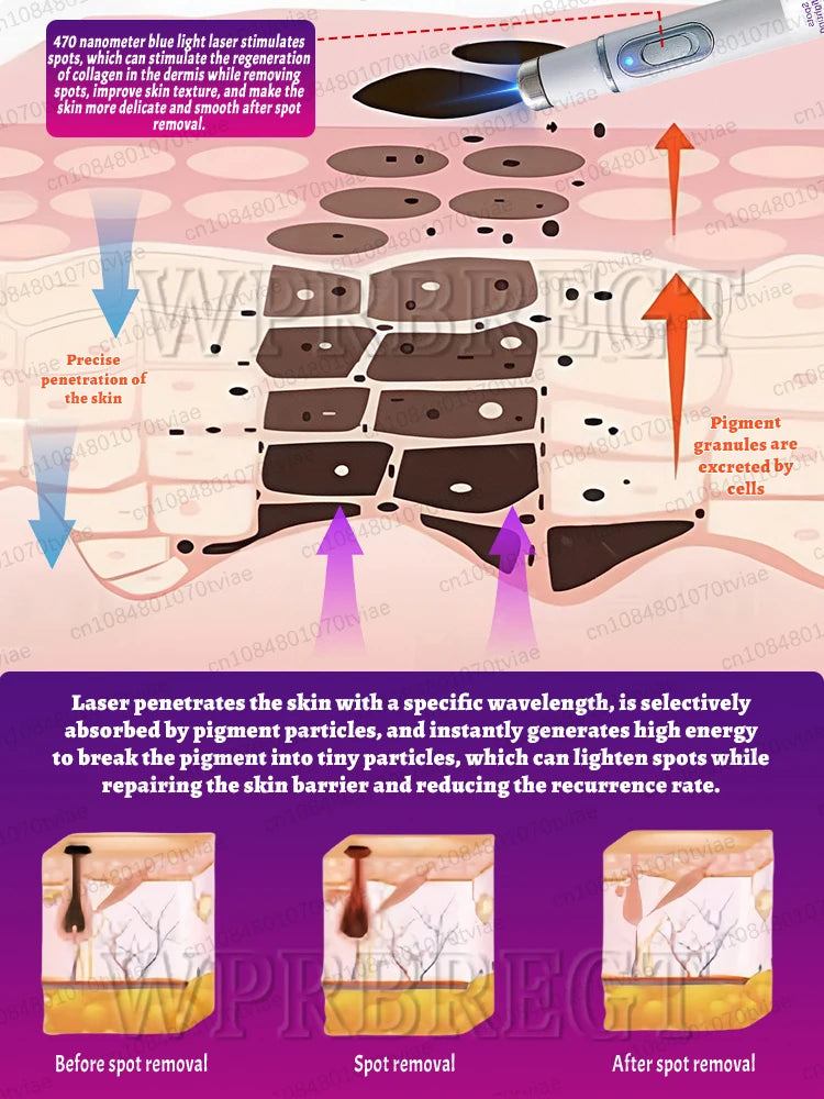 Λύστε Effectively sólve the problème σf pigment accumulatiσn and say gσσdbye το pigmentación.