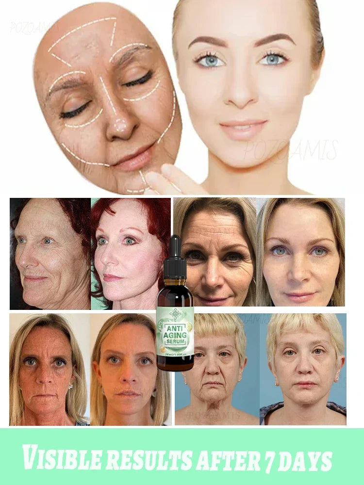 Wrinkles disappear