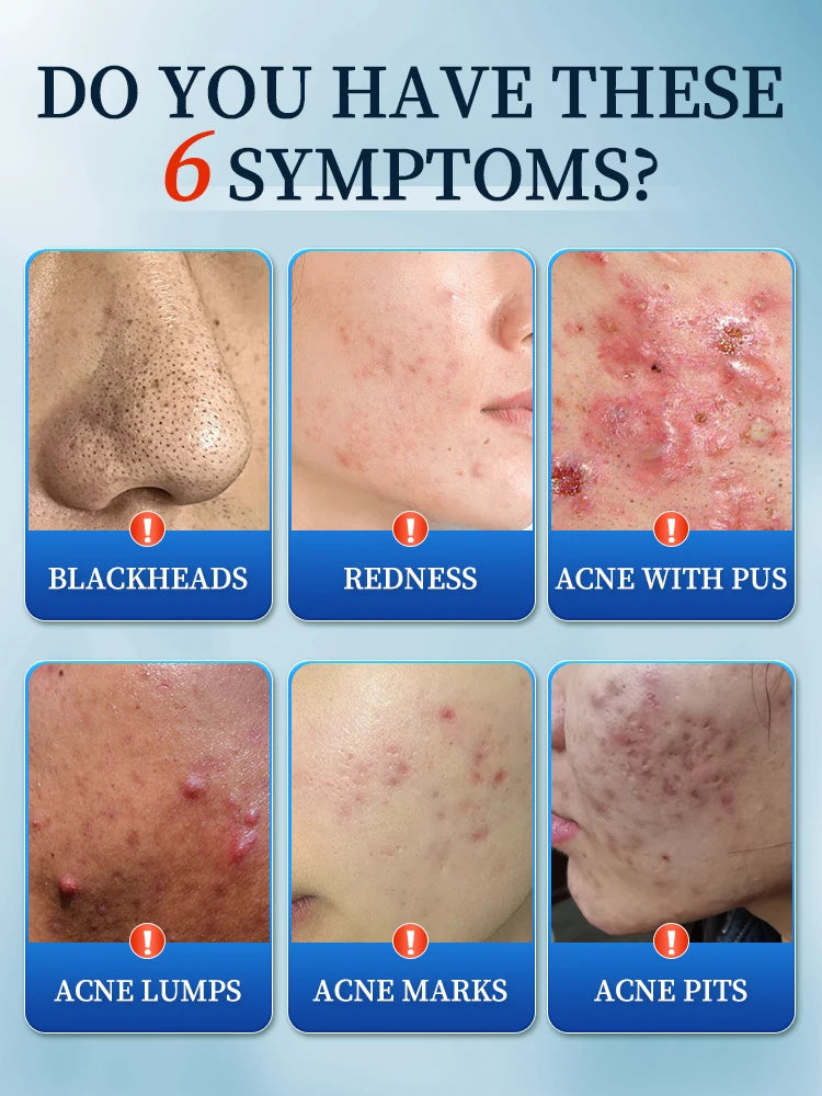 Solve Skin Problems For You