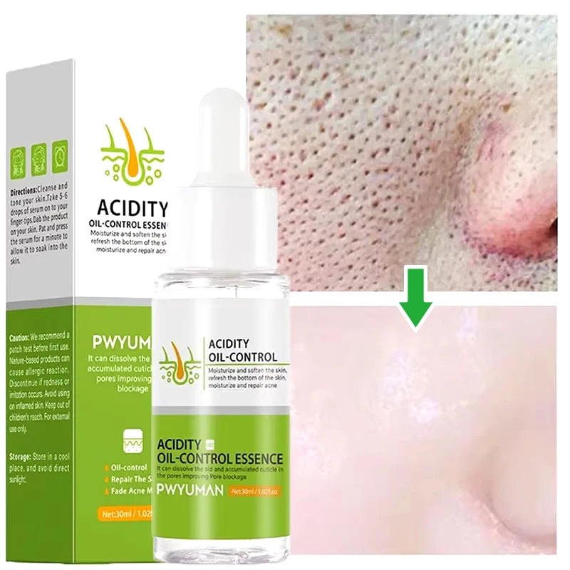 Salicylic Acid Pore Shrinking Cream Eliminate Large Pores Serum Remove Blackhead Acne Repairing Tightening Skin Care Cosmetics