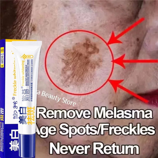 Powerful Spot-Removing Whiten Cream Brighten Skin Fast Eliminates Melanin Pigmentation Melasma Dark Spots Korean Face Skin Care