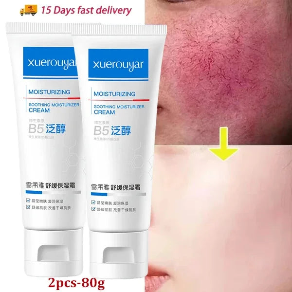B5 Repair Facial Redness Cream Instant Spider Vein Remove Sensitive Skin Sooth Anti Redness Rosacea Treat Lotion Korean Cosmetic