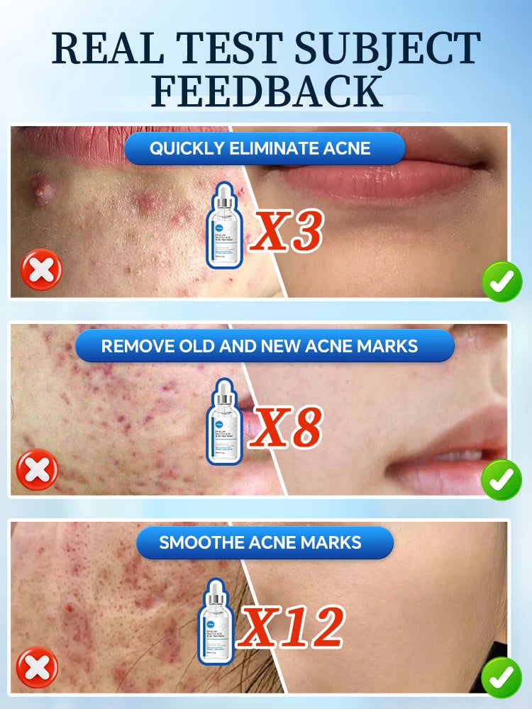 Solve Skin Problems For You
