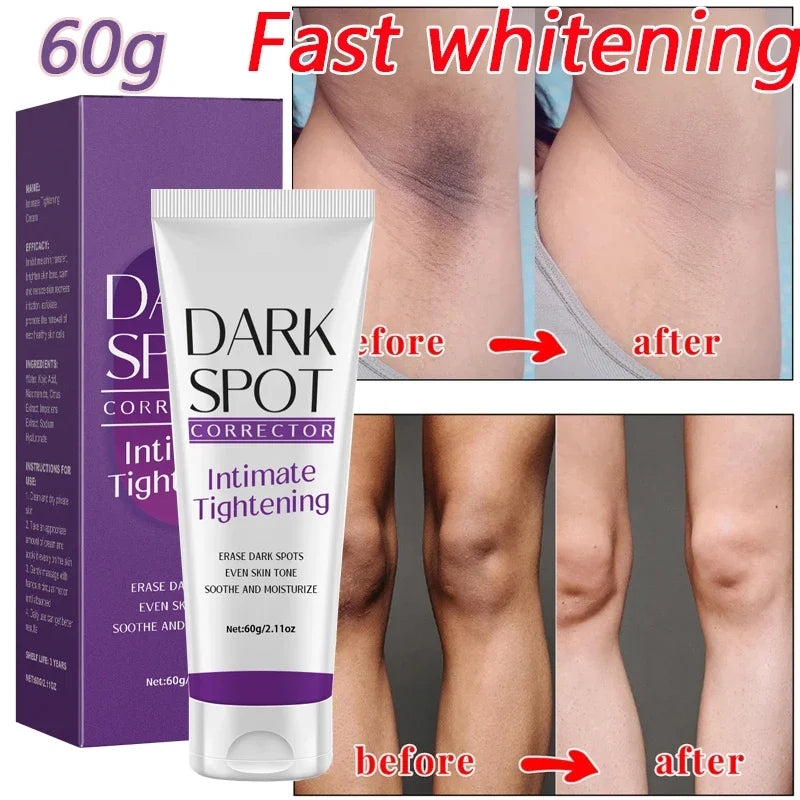 Body Whitening Cream Private Parts Underarm Knee Thigh Inner Melanin Bleaching Brighten Lotion Dark Skin Healthy White Body Care