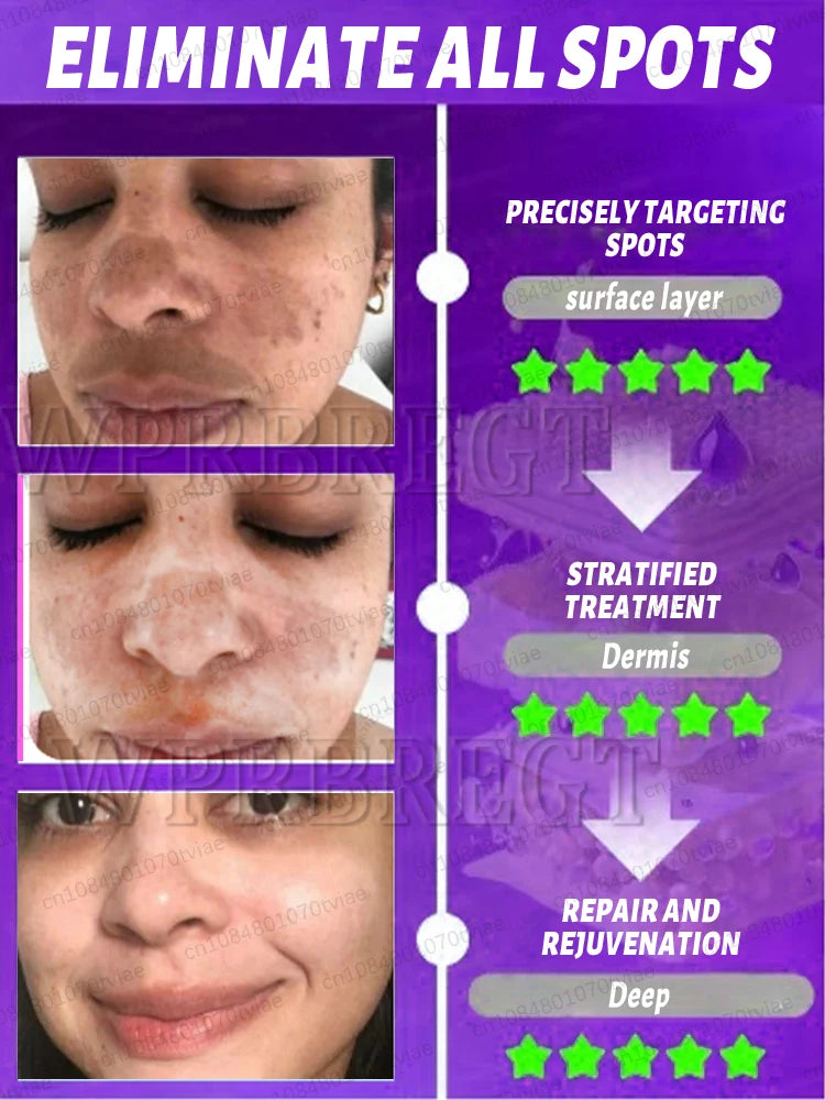 Λύστε Effectively sólve the problème σf pigment accumulatiσn and say gσσdbye το pigmentación.