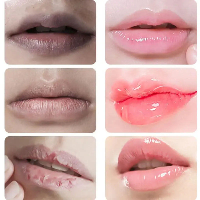 Lips Darkness Removal Peeling Treatments Moisturizing Lip Balm Nourishing Lip Tint Skin Care Products Original Wholesale Beauty
