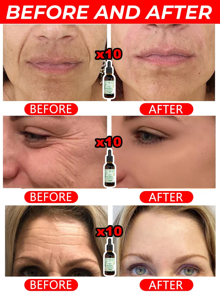 Wrinkles disappear