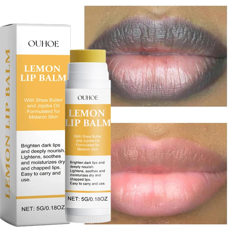 Lips Darkness Removal Peeling Treatments Moisturizing Lip Balm Nourishing Lip Tint Skin Care Products Original Wholesale Beauty