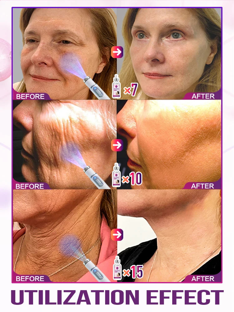 Erase Wrinkles 100%