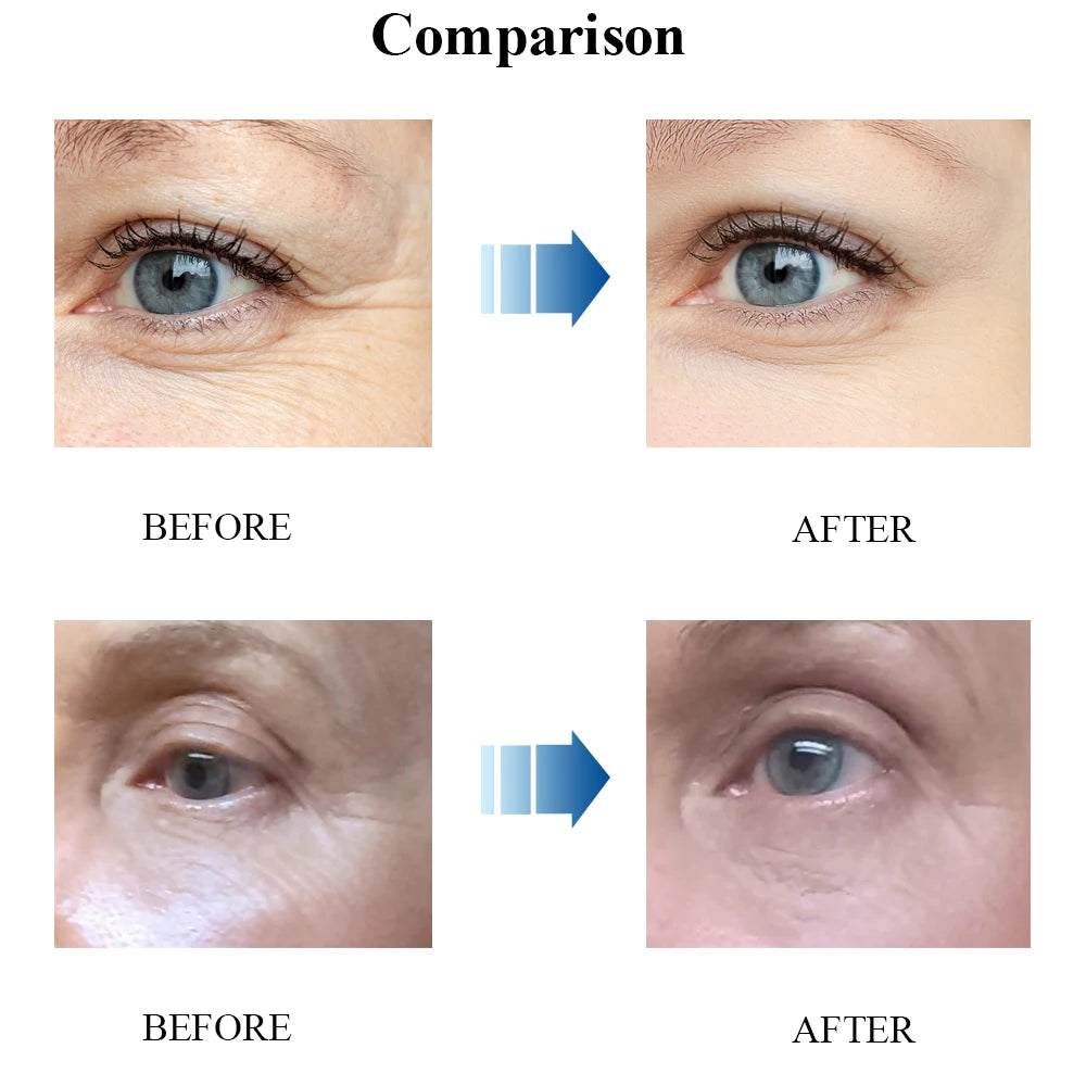 ENVISHA Eye Cream Remove Dark Circles Puffiness Moisturizing Anti Wrinkle Aging Whitening Face Cream Skin Care Korean Cosmetics