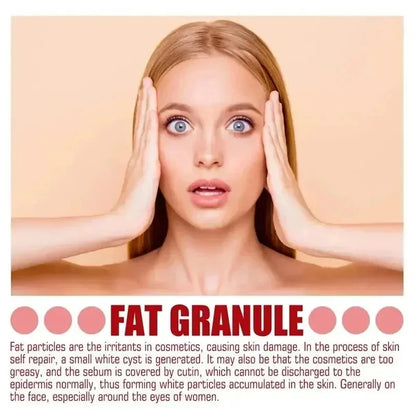 Fat Granules Remover Eye Cream Effective Remove Fat Granules Puffiness Anti-Particles Milia Remover Product Repair Eye Skin Care