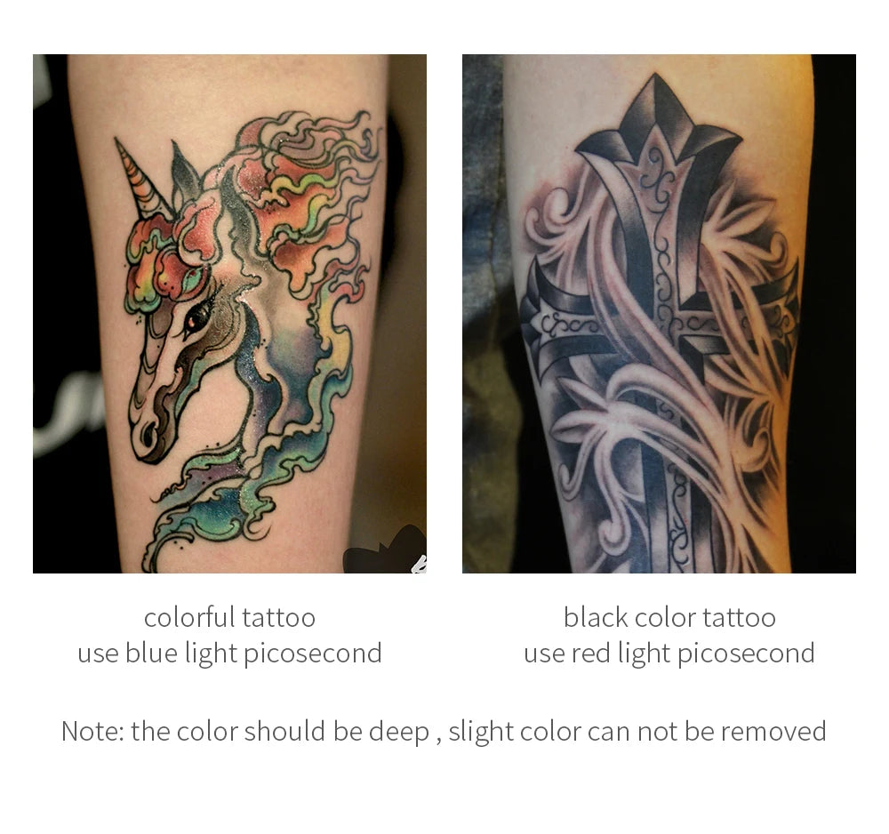 Picosecond Laser Pen Freckle Tattoo Removal Dark Spot Remover Blue & Red Light Machine Portable Scar Mole Remover Beauty Care