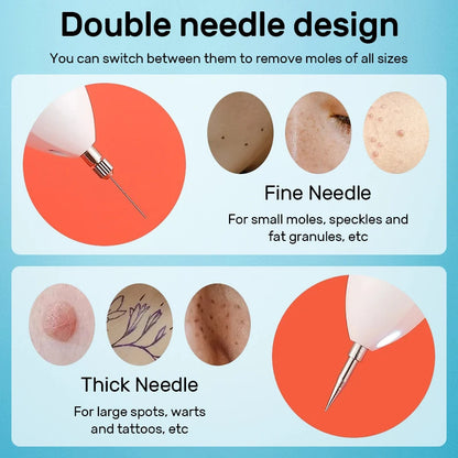 Laser Plasma Pen Mole Wart Skin Tag Remover Black Dots Freckle Dark Spot Wart Eliminator Papilloma Nevus Remover Plasma Pen