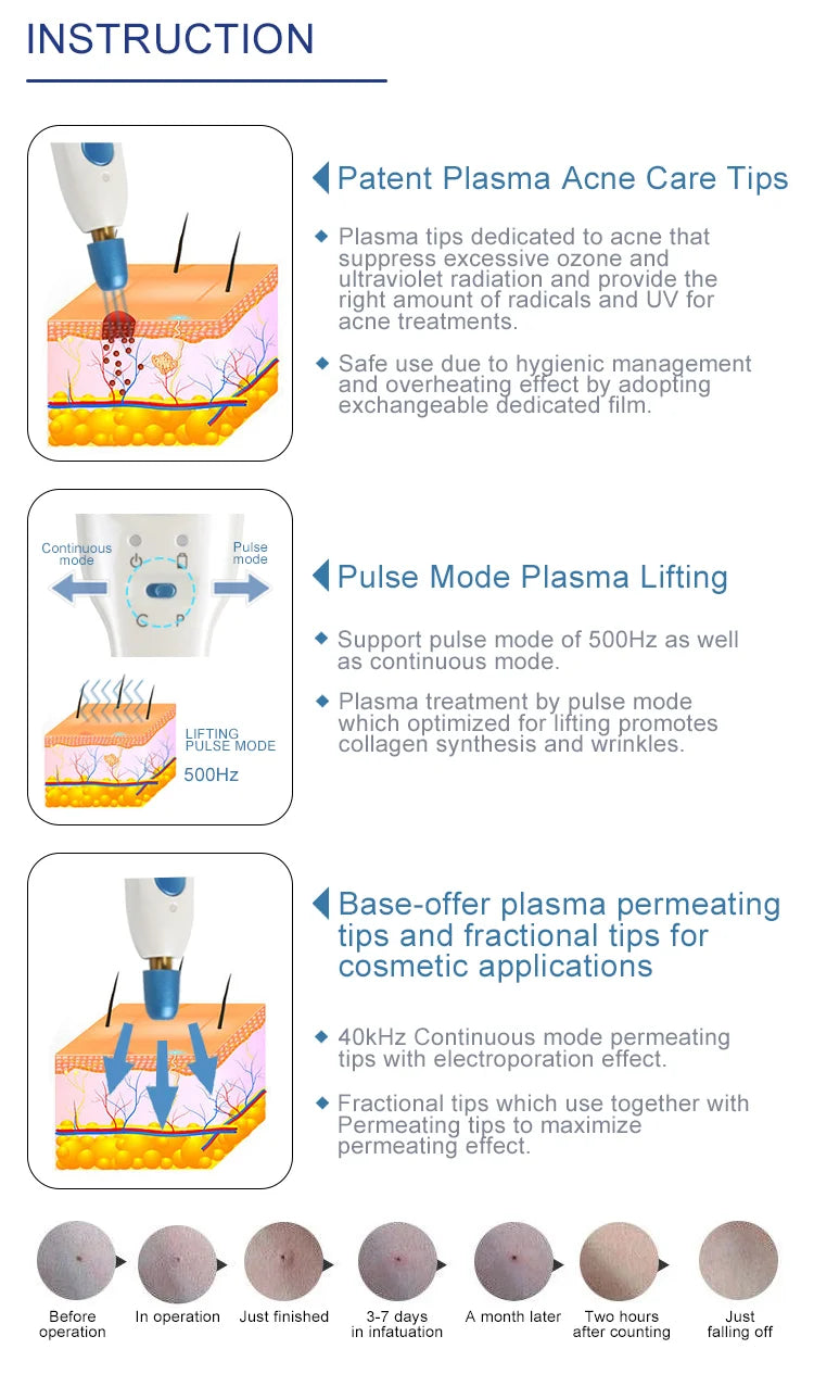 Plasma Pen Cold Skin Tag Wart Remover Dark Spot Fibroblast Therapy Eye Lift Skin Tightening Beauty Device