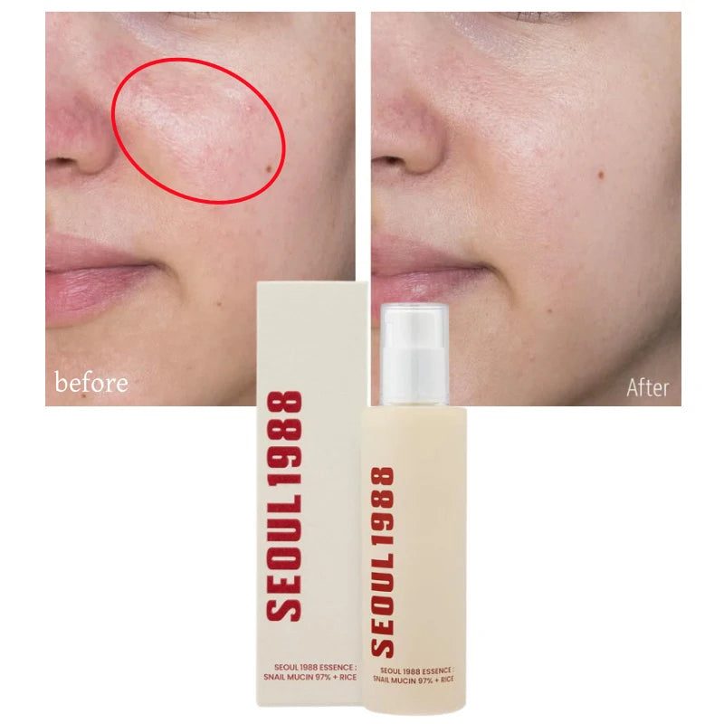 Seoul 1988 Korean Skin Care Set Snail Mucin Eye Contour Care Vitamin C Retinol Dark Circles Removal Seoul 1988 Korean Cosmetics