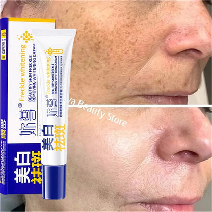 Powerful Spot-Removing Whiten Cream Brighten Skin Fast Eliminates Melanin Pigmentation Melasma Dark Spots Korean Face Skin Care