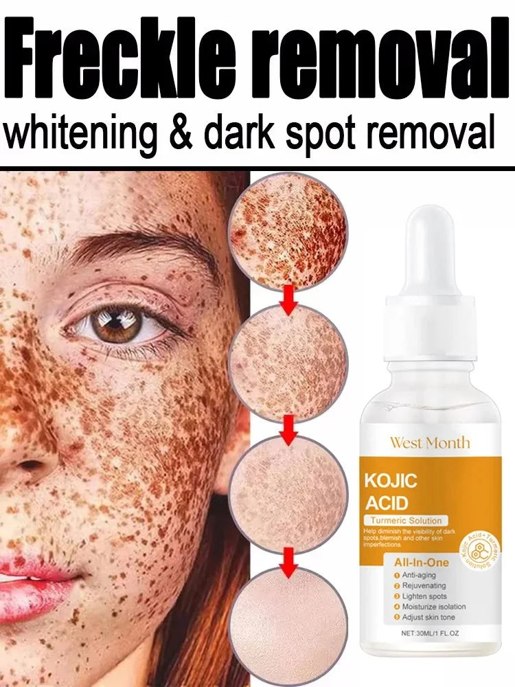 Kojic Acid Freckle Removing Whitening Essence Fade Pigmentation Melasma Dark Spots Corrector Repair Serum Korean Skin Care