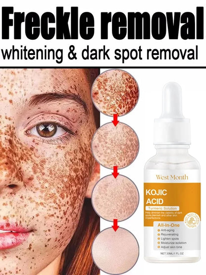 Kojic Acid Freckle Removing Whitening Essence Fade Pigmentation Melasma Dark Spots Corrector Repair Serum Korean Skin Care