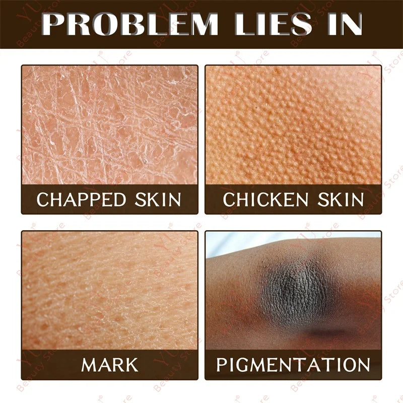 Sakura Skin Whitening Cream Dark Spots Removal Bleach Body Care Lotion Permanently Woman Beauty Moisturizing Korean Cosmetics