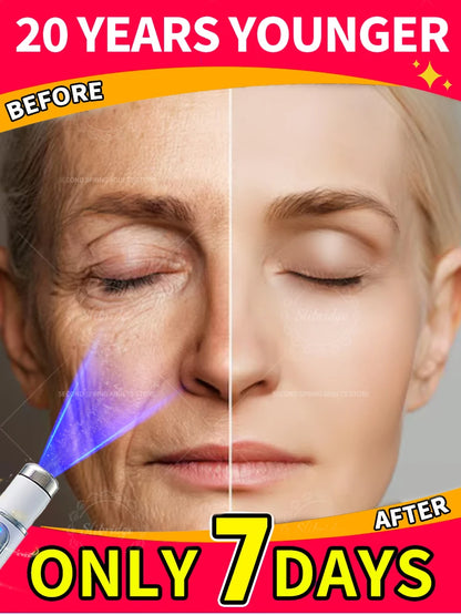 Erase Wrinkles 100%