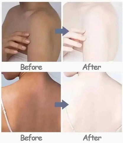 Body Whitening Cream Private Parts Underarm Knee Thigh Inner Melanin Bleaching Brighten Lotion Dark Skin Healthy White Body Care