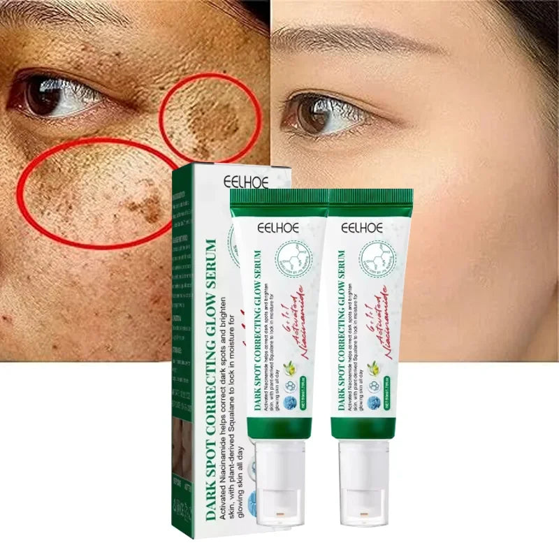 Dark Spot Corrector Cream Reduces Dark Spots Brightening Care Hydrates and Nourishes skin Reduces Melanin Fades Spots  Freckles