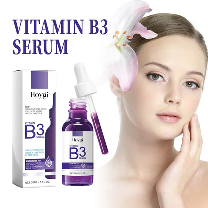 Hoygi Niacinamide Facial Serum Vitamin B3 Wrinkles Pigment Dark Spot Removal Correcting Glow Serum Face Whitening Moisturizer