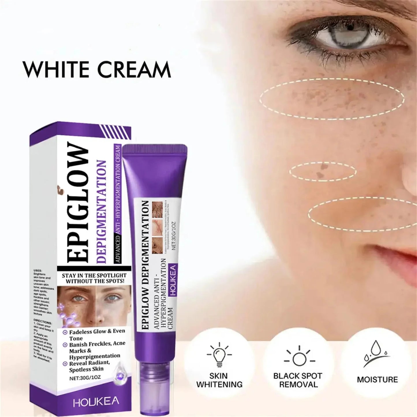 Retinol Whitening Freckle Cream Melasma Dark Spots Pigmentation Removal Fade Stain Melanin Fast Repair Brighten Korean Skin Care