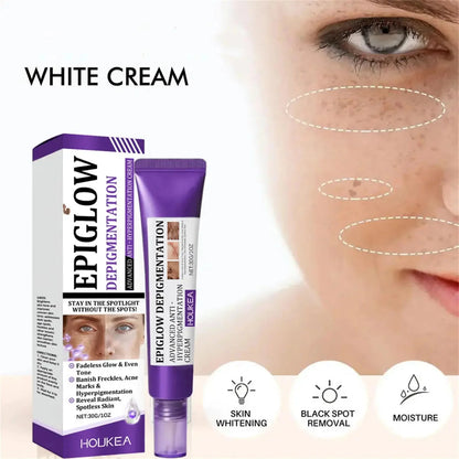 Retinol Whitening Freckle Cream Melasma Dark Spots Pigmentation Removal Fade Stain Melanin Fast Repair Brighten Korean Skin Care