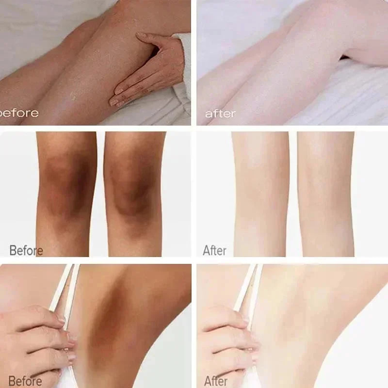 Body Whitening Cream Private Parts Underarm Knee Thigh Inner Melanin Bleaching Brighten Lotion Dark Skin Healthy White Body Care
