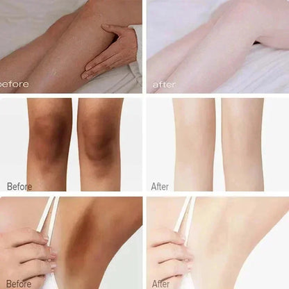 Body Whitening Cream Private Parts Underarm Knee Thigh Inner Melanin Bleaching Brighten Lotion Dark Skin Healthy White Body Care