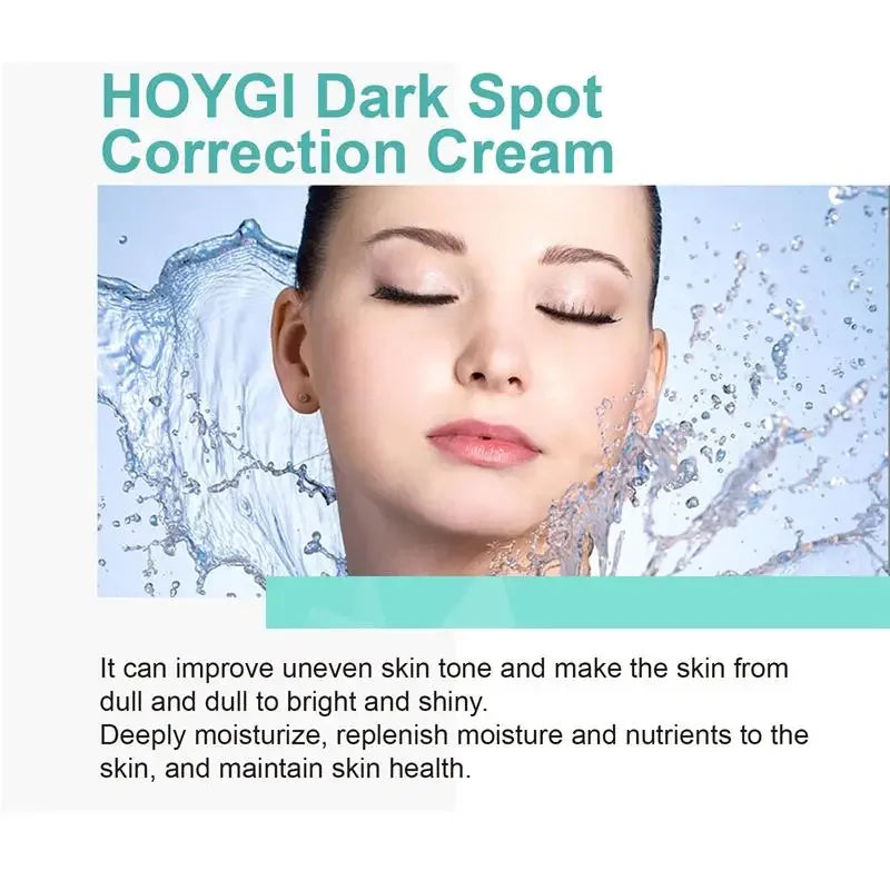 Powerful Spot-removing Whiten Cream Brighten Skin Fast Eliminates Melanin Pigmentation Melasma Dark Spots Moisturize Beauty Gel