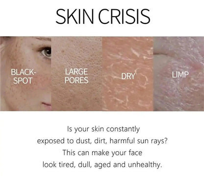 Retinol Whitening Freckle Cream Melasma Dark Spots Pigmentation Removal Fade Stain Melanin Fast Repair Brighten Korean Skin Care