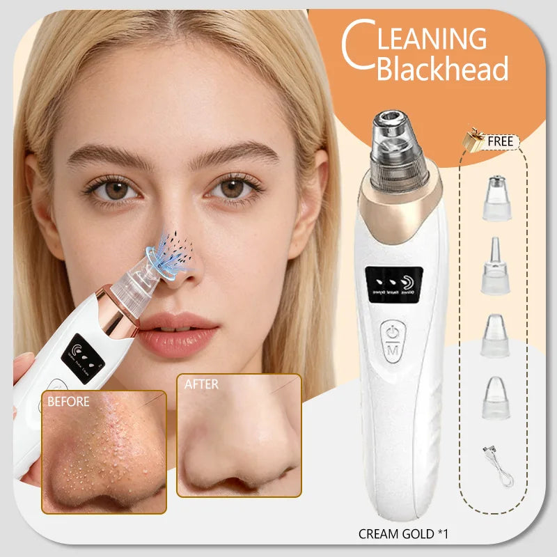 Professional Blackhead Vacuum - Rechargeable Pore Extractor for Blackheads, Oily Skin & Facial Cleansing