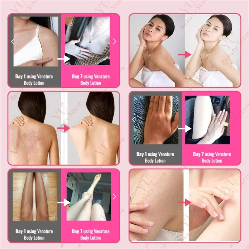 Sakura Skin Whitening Cream Dark Spots Removal Bleach Body Care Lotion Permanently Woman Beauty Moisturizing Korean Cosmetics