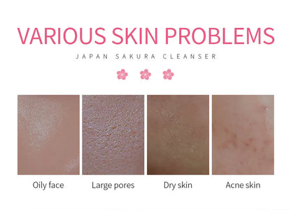 LAIKOU Sakura Facial Cleanser 50g – Deep Cleansing, Brightening & Moisturising