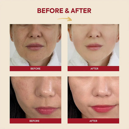 Seoul 1988 Korean Skin Care Set Snail Mucin Eye Contour Care Vitamin C Retinol Dark Circles Removal Seoul 1988 Korean Cosmetics