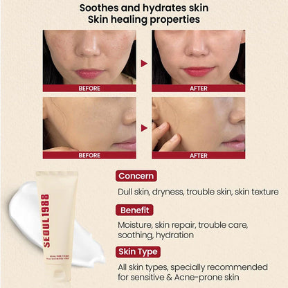 Seoul 1988 Korean Skin Care Set Snail Mucin Eye Contour Care Vitamin C Retinol Dark Circles Removal Seoul 1988 Korean Cosmetics