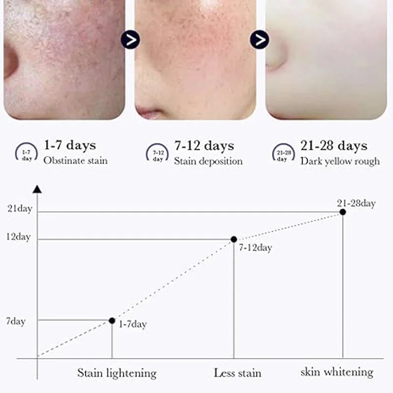 Dark Spot Corrector Cream Reduces Dark Spots Brightening Care Hydrates and Nourishes skin Reduces Melanin Fades Spots  Freckles