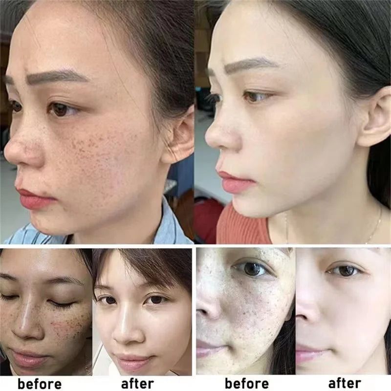 White Rice Whitening Cream Remove Dark Spots Fade Freckle Melanin Repair Product Anti Wrinkle Moisturizing Brighten Facial Care