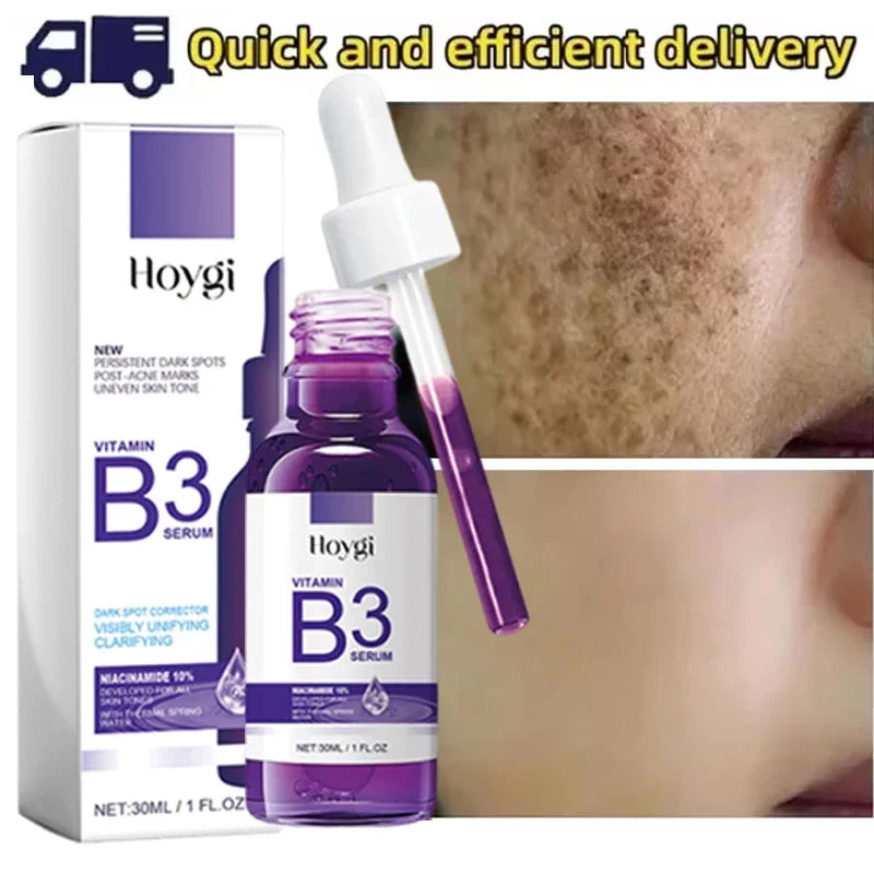 Hoygi Niacinamide Facial Serum Vitamin B3 Wrinkles Pigment Dark Spot Removal Correcting Glow Serum Face Whitening Moisturizer