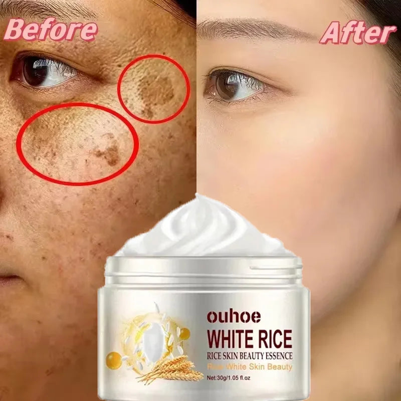 White Rice Whitening Cream Remove Dark Spots Fade Freckle Melanin Repair Product Anti Wrinkle Moisturizing Brighten Facial Care