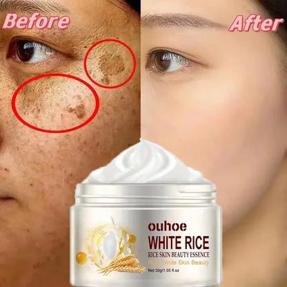 White Rice Whitening Cream Remove Dark Spots Fade Freckle Melanin Repair Product Anti Wrinkle Moisturizing Brighten Facial Care