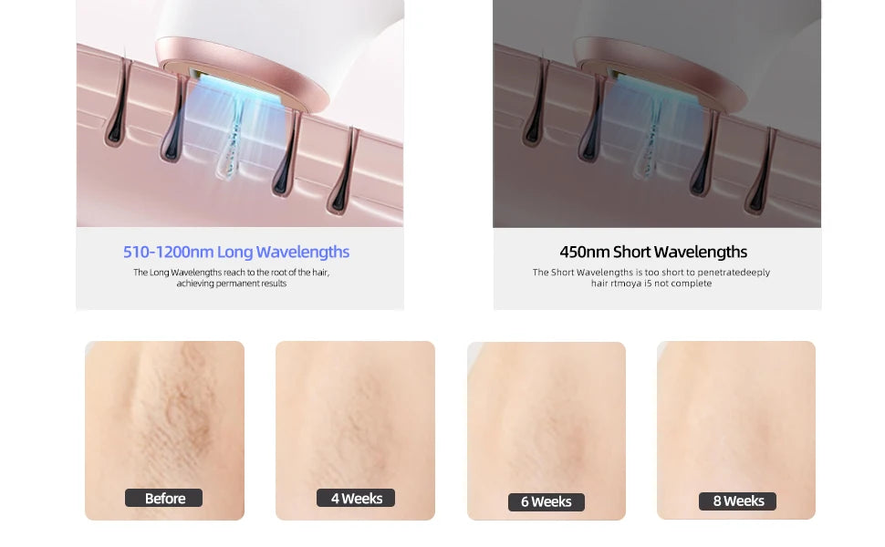 Home Use Ipl Machine Epilation Laser Ice Cooling Professional Portable Laser Hair Removal Machine