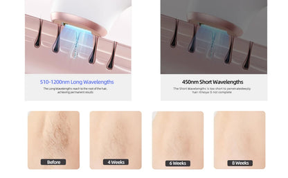 Home Use Ipl Machine Epilation Laser Ice Cooling Professional Portable Laser Hair Removal Machine