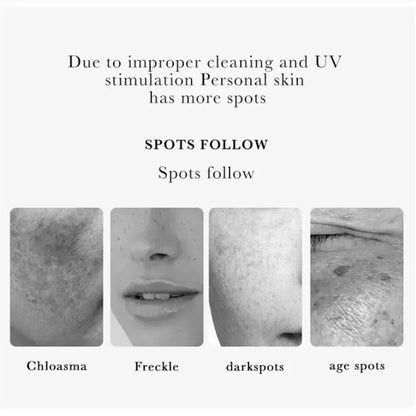 Effective whitening cream for freckles, removes Melasma, dark spots, pigmentation, moisturizer, lightens the face,