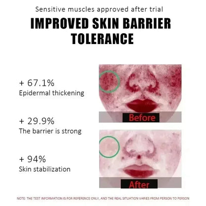 Repair Facial Redness Cream Instant Spider Vein Remove Sensitive Skin Sooth Anti Redness Rosacea Treat Lotion Korean Cosmetics