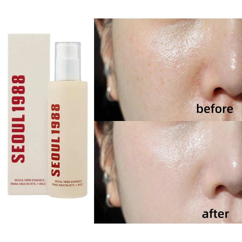 Seoul 1988 Korean Skin Care Set Snail Mucin Eye Contour Care Vitamin C Retinol Dark Circles Removal Seoul 1988 Korean Cosmetics