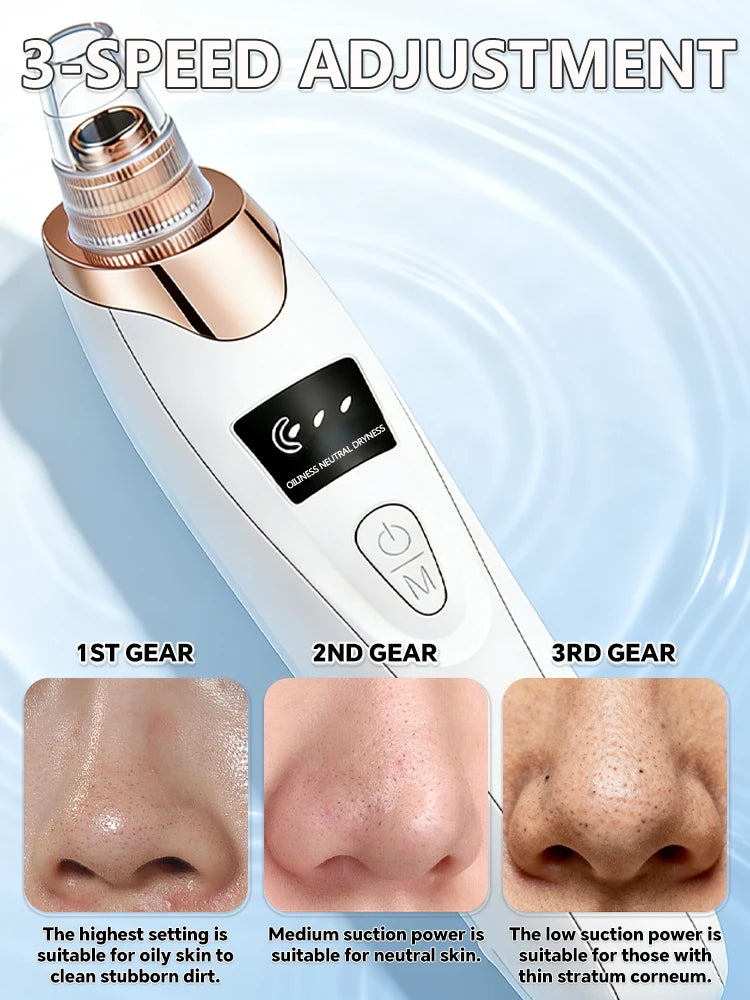 Professional Blackhead Vacuum - Rechargeable Pore Extractor for Blackheads, Oily Skin & Facial Cleansing